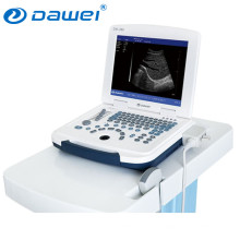 neuer Hand-Ultraschall-Scanner und tragbarer Ultraschall für die Schwangerschaft